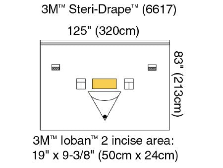 Orthopedic Drape 3M™ Steri-Drape™ Isolation Drape with Incise and Pouch 125 W X 83 L Inch Sterile