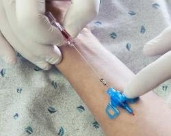 Closed IV Catheter Introcan Safety® 3 20 Gauge 1 Inch Sliding Safety Needle